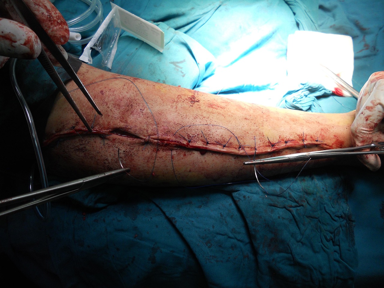 How Do You Choose the Best Orthopedic Surgeon New Orleans For Your Needs?