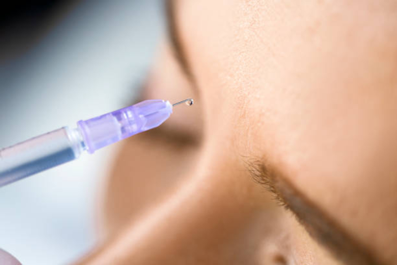 best botox in surrey