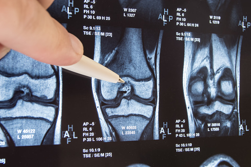 New Orleans orthopedic surgeons
