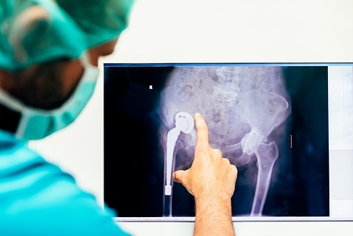 New Orleans orthopedic surgeons