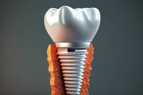 affordable dentures cookeville tn