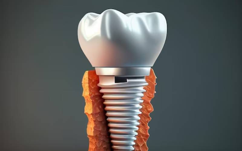 affordable dentures cookeville tn