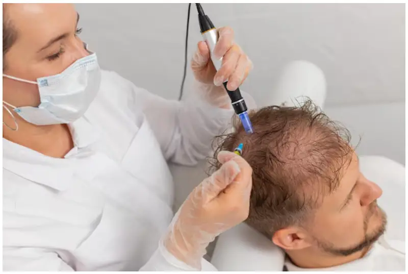 FUE Hair Transplant In Istanbul